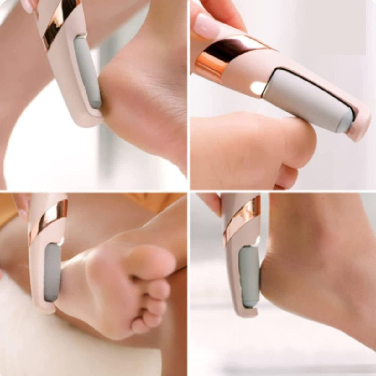 Flawless Pedi™ Electric Foot File & Callus Remover