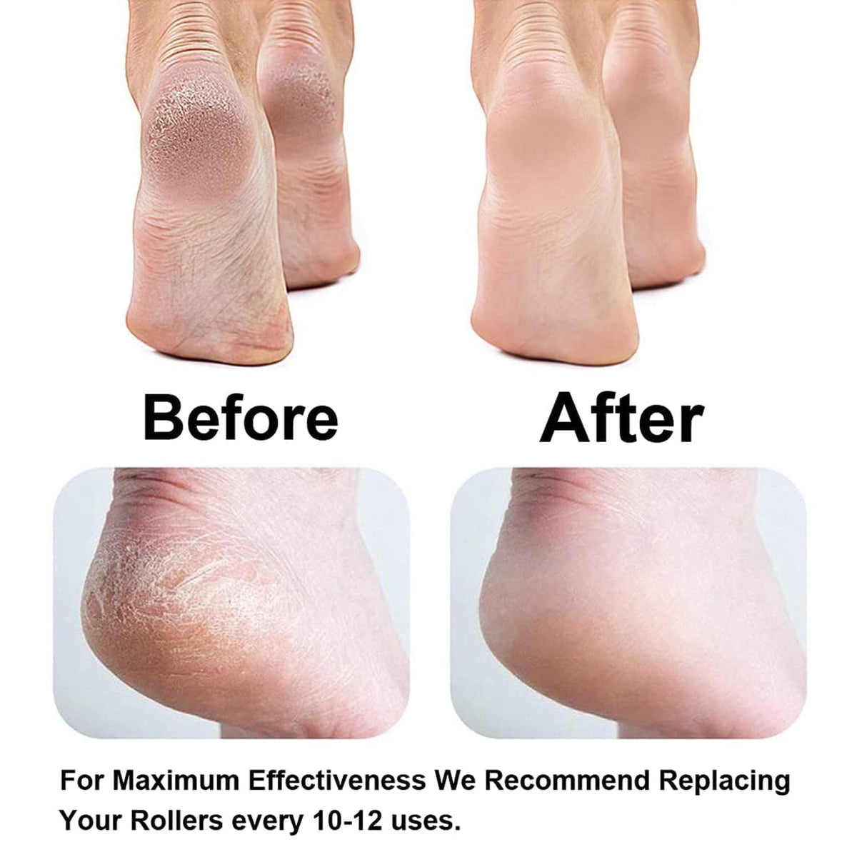 Flawless Pedi™ Electric Foot File & Callus Remover